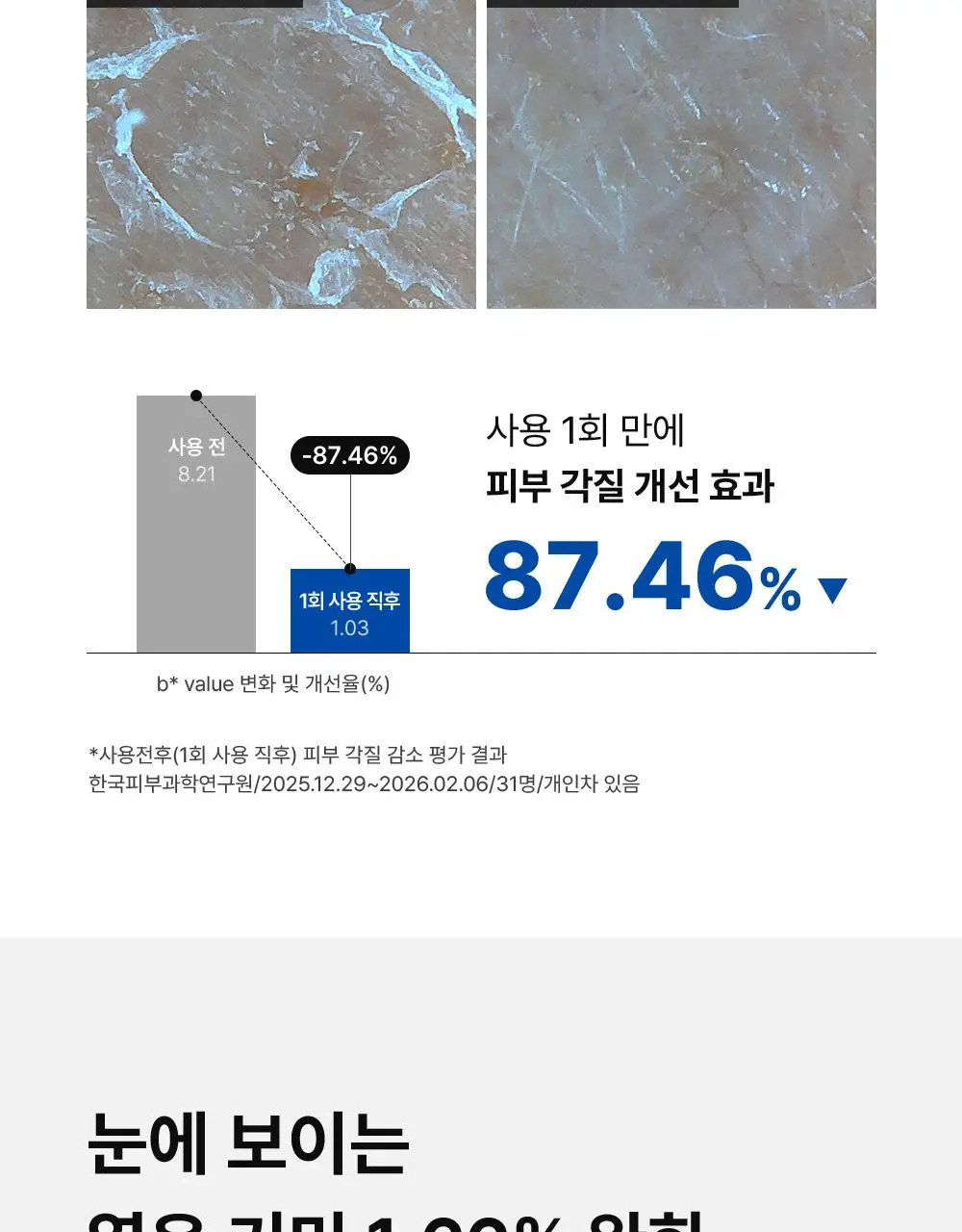 [단독기획] 동아제약 색소침착 프로 액제 30ml 기획(+크림제5ml) 상세페이지 12